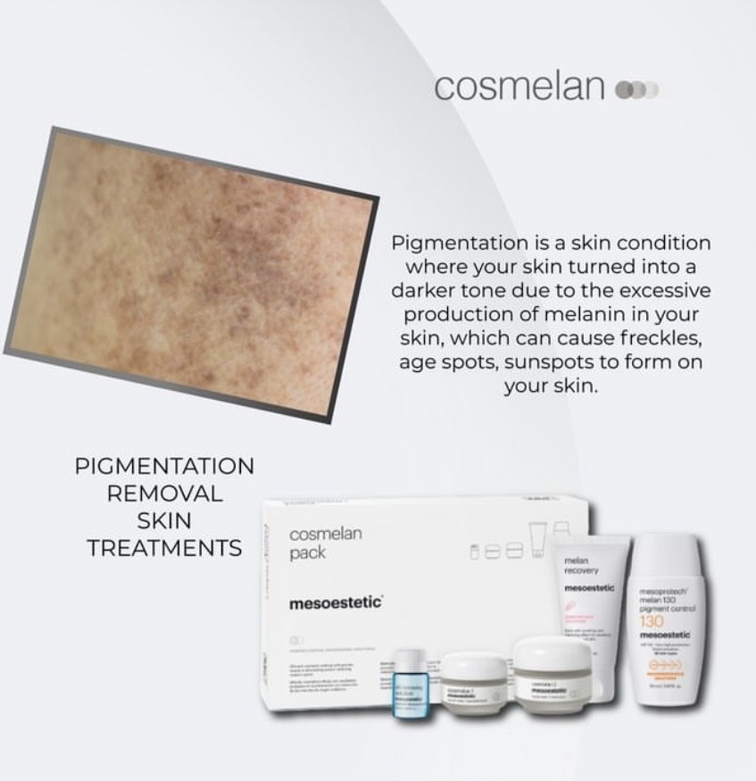 Cosmelan-Pigmentation-Treatment